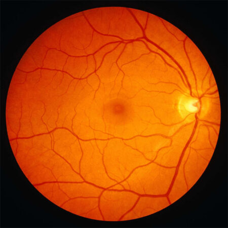 optic nerve