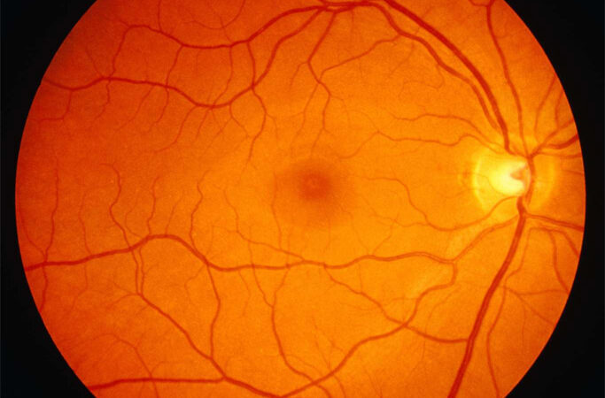 optic nerve