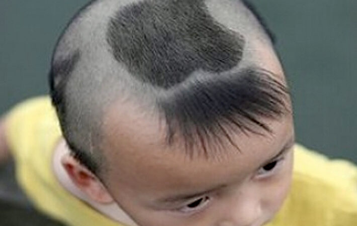 apple head
